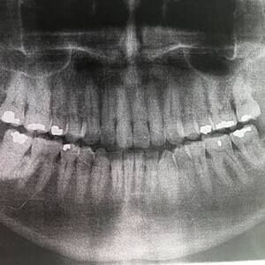 Meet your Posher, Greg